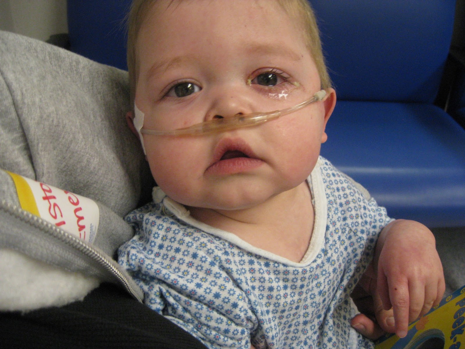 Emerson Family A Couple of Surgeries